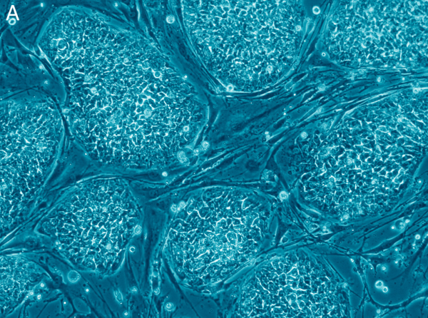 As células-tronco embrionárias têm a capacidade de se transformar em qualquer célula do corpo humano (Foto: Wikimedia Commons)