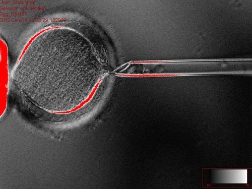 A retirada do núcleo dos óvulos é o primeiro passo para o processo de clonagem de embriões humanos. A técnica pode abrir novos caminhos para o tratamento de diversas doenças (Foto: OHSU) 