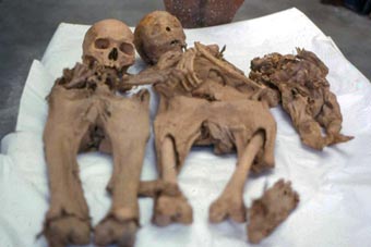 Múmias brasileiras do século 18 descobertas debaixo de Igreja em Minas Gerais ainda conservam o conteúdo do intestino (Foto: Escola Nacional de Saúde Pública/Ensp)