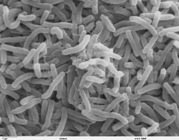 Nem sempre as bactérias são as vilãs da história. É verdade que algumas causam doenças, mas outras podem nos ajudar de muitas formas (foto: Kirn et al / Wikimedia Commons)
