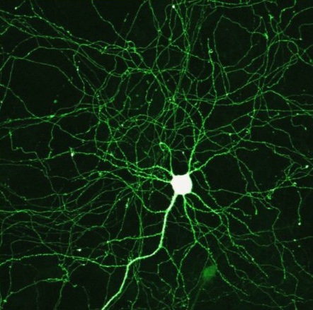 Os neurônios – que conhecemos por serem células do cérebro – também estão presentes no sistema digestório (Foto: Mark Miller / Flickr)