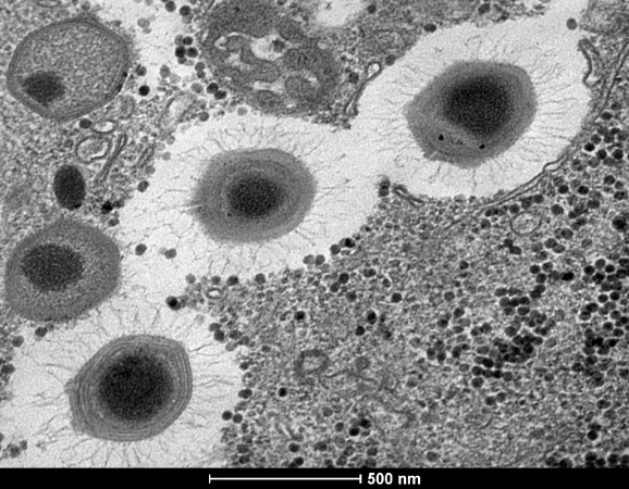 No microscópio, um vírus gigante! (foto: Divulgação)