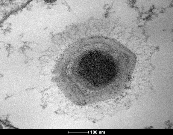 O Samba mede 600 nanômetros de diâmetro – para um vírus, é muita coisa! Um nanômetro é a distância que temos quando dividimos um centímetro em dez milhões de pedacinhos. Para você ter uma ideia: a comparação do tamanho da Lua com o tamanho de uma moeda de um centavo é aproximadamente a mesma que a comparação entre o tamanho de uma bola de futebol e o tamanho de um nanômetro. (foto: Divulgação)