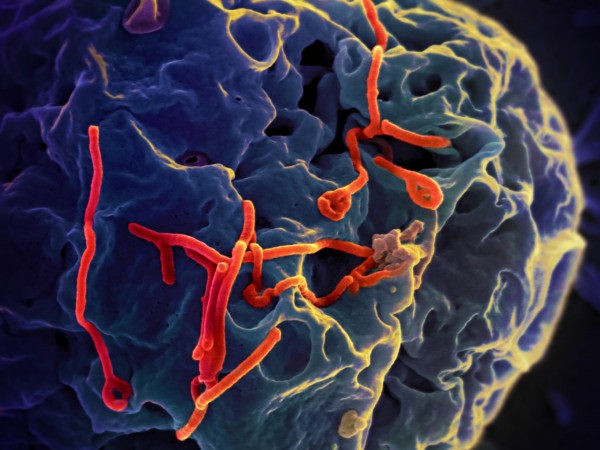 Veja, em vermelho, o vírus ebola, que recebe esse nome por ter sido descoberto em um paciente infectado próximo ao rio Ebola, localizado no Congo. (foto: NIAID / Flickr / <a href=https://creativecommons.org/licenses/by/2.0/> CC BY 2.0 </a>)