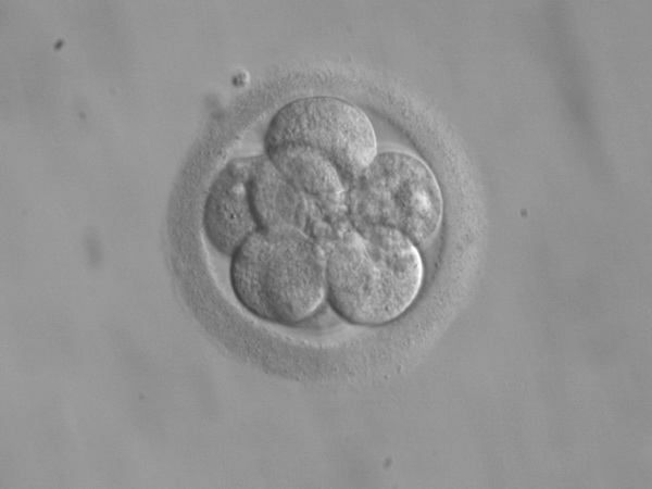 Todos nós um dia fomos uma só célula, que foi se dividindo (como nesta imagem), crescendo e se transformando dia após dia, até formar um corpo. (foto: Wikimedia Commons)